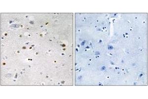 Immunohistochemistry analysis of paraffin-embedded human brain tissue, using ZNF7 Antibody. (ZNF7 antibody  (AA 41-90))