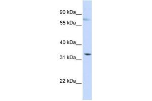 SIGLEC6 antibody used at 1 ug/ml to detect target protein. (SIGLEC6 antibody  (N-Term))