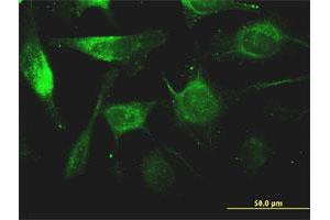 Immunofluorescence of monoclonal antibody to FTL on HeLa cell. (FTL antibody)