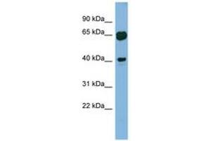 Image no. 1 for anti-RAB3A Interacting Protein (Rabin3)-Like 1 (RAB3IL1) (AA 143-192) antibody (ABIN6741928) (RAB3IL1 antibody  (AA 143-192))