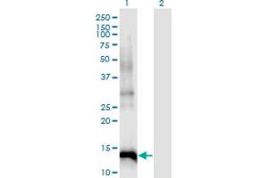 Western Blot analysis of CDKN2B expression in transfected 293T cell line by CDKN2B monoclonal antibody (M07), clone 8C4.