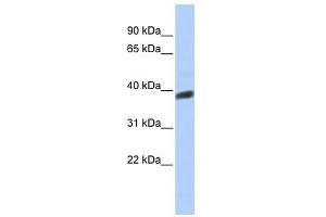 INSIG1 antibody used at 1 ug/ml to detect target protein.