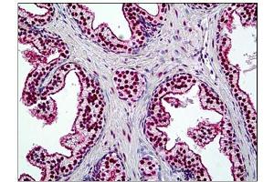 Human Prostate: Formalin-Fixed, Paraffin-Embedded (FFPE) (SMARCA4 antibody  (N-Term))