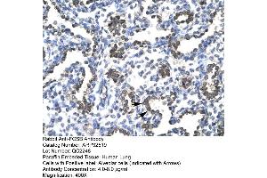 Human Lung (FOSB antibody  (C-Term))