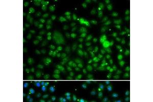 Immunofluorescence analysis of MCF-7 cells using NSUN6 Polyclonal Antibody (NSUN6 antibody)