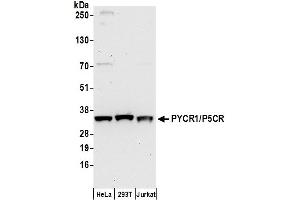 Western Blotting (WB) image for anti-Pyrroline-5-Carboxylate Reductase 1 (PYCR1) (AA 269-319) antibody (ABIN7450621)