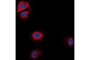 Immunofluorescent analysis of GPR170 staining in MCF7 cells. (OXER1 antibody)
