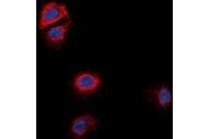 Immunofluorescent analysis of GPR170 staining in MCF7 cells.