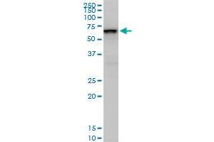 SMARCD2 monoclonal antibody (M02), clone 2B2. (SMARCD2 antibody  (AA 398-474))