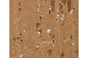 Immunohistochemistry (IHC) image for anti-Nerve Growth Factor Receptor (TNFRSF16) Associated Protein 1 (NGFRAP1) antibody (ABIN2430497) (Nerve Growth Factor Receptor (TNFRSF16) Associated Protein 1 (NGFRAP1) antibody)