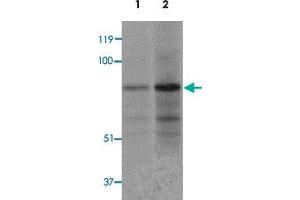 Western blot analysis of EZH1 in mouse lung tissue lysate with EZH1 polyclonal antibody  at 1 ug/mL (lane 1) and 2 ug/mL (lane 2). (EZH1 antibody  (N-Term))