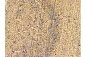 Phospho-BLNK (Tyr84) Antibody at 1/100 staining Rat brain tissue by IHC-P.