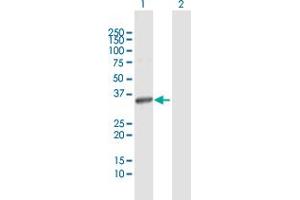 Western Blot analysis of ITPK1 expression in transfected 293T cell line by ITPK1 MaxPab polyclonal antibody. (ITPK1 antibody  (AA 1-314))