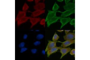 ABIN7095313 and ABIN7099370 staining Hela cells(45 min of heat-shock treatment) by IF/ICC. (C2CD2 antibody)