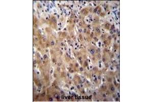 Glypican 3 (GPC3) Antibody (N-term) (ABIN390317 and ABIN2840749) immunohistochemistry analysis in formalin fixed and paraffin embedded human liver tissue followed by peroxidase conjugation of the secondary antibody and DAB staining. (Glypican 3 antibody  (N-Term))