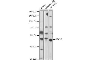 Western blot analysis of extracts of various cell lines, using RBCK1 antibody (ABIN7269848) at 1:1000 dilution. (RBCK1 antibody)