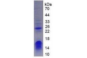 SDS-PAGE analysis of Human CHD3 Protein. (CHD3 Protein)
