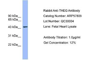 WB Suggested Anti-THEG  Antibody Titration: 0.