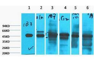 Western Blotting (WB) image for anti-Keratin 18 (KRT18) antibody (ABIN3178648) (Cytokeratin 18 antibody)