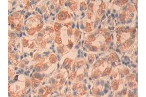 Detection of CYR61 in Human Stomach Tissue using Polyclonal Antibody to Cysteine Rich Protein, Angiogenic Inducer 61 (CYR61) (CYR61 antibody  (AA 178-381))