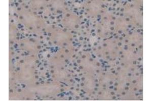 IHC-P analysis of Mouse Kidney Tissue, with DAB staining. (TICAM1 antibody  (AA 263-526))