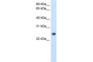 Western Blotting (WB) image for anti-gamma-Glutamyltransferase Light Chain 1 (GGTLC1) antibody (ABIN2462441) (GGTLC1 antibody)