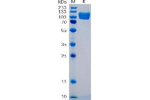 Human ICAM-1 Protein, mFc Tag on SDS-PAGE under reducing condition. (ICAM1 Protein (AA 48-480) (mFc Tag))