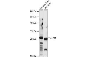Western blot analysis of extracts of various cell lines, using EBP antibody (ABIN7266934) at 1:1000 dilution. (EBP antibody  (AA 50-150))