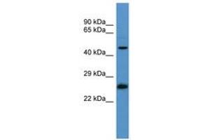 Image no. 1 for anti-RAB8B, Member RAS Oncogene Family (RAB8B) (AA 104-153) antibody (ABIN6746637) (RAB8B antibody  (AA 104-153))