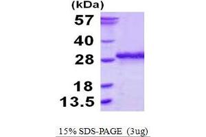 SDS-PAGE (SDS) image for SSU72 RNA Polymerase II CTD Phosphatase Homolog (SSU72) (AA 1-194) protein (His tag) (ABIN667667) (SSU72 Protein (AA 1-194) (His tag))