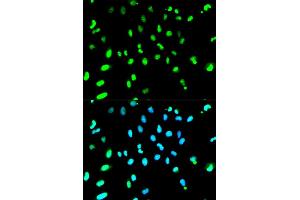 Immunofluorescence analysis of HeLa cells using TARDBP antibody (ABIN5970529).