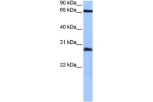 Western Blotting (WB) image for anti-Homeobox C6 (HOXC6) antibody (ABIN2463858)