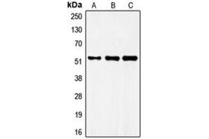 Western blot analysis of FRS3 expression in MCF7 (A), mouse brain (B), rat brain (C) whole cell lysates. (FRS3 antibody  (Center))