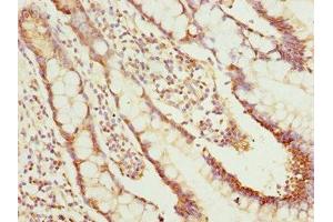 Immunohistochemistry of paraffin-embedded human small intestine tissue using ABIN7161726 at dilution of 1:100 (NLE1 antibody  (AA 206-485))