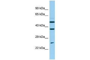 Western Blotting (WB) image for anti-Nudix (Nucleoside Diphosphate Linked Moiety X)-Type Motif 14 (NUDT14) (N-Term) antibody (ABIN2444679) (NUDT14 antibody  (N-Term))