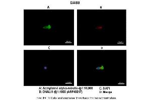 Immunohistochemistry (IHC) image for anti-Growth Arrest-Specific 8 (GAS8) (Middle Region) antibody (ABIN2783195)
