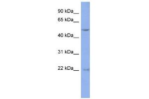 WB Suggested Anti-DAZ3 Antibody Titration:  0.