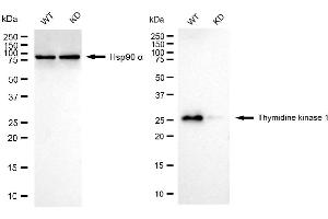 Western blotting analysis using thymidine kinase 1 antibody (ABIN7800551).