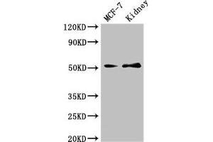 Western Blot Positive WB detected in: MCF-7 whole cell lysate, Mouse kidney tissue All lanes: GFRA1 antibody at 3 μg/mL Secondary Goat polyclonal to rabbit IgG at 1/50000 dilution Predicted band size: 52, 51 kDa Observed band size: 52 kDa (GFRA1 antibody  (AA 230-385))