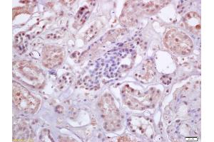 Formalin-fixed and paraffin embedded human kidney labeled with Anti-IRF3 Polyclonal Antibody, Unconjugated (ABIN682588) at 1:200 followed by conjugation to the secondary antibody and DAB staining (IRF3 antibody  (AA 51-150))