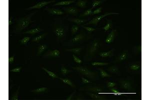 Immunofluorescence of monoclonal antibody to BAG5 on HeLa cell. (BAG5 antibody  (AA 1-447))