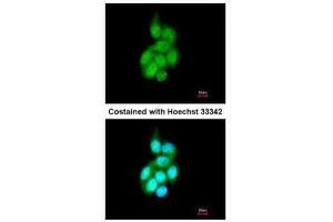 ICC/IF Image Immunofluorescence analysis of methanol-fixed A431, using BAIAP2L1, antibody at 1:200 dilution. (BAIAP2L1 antibody)