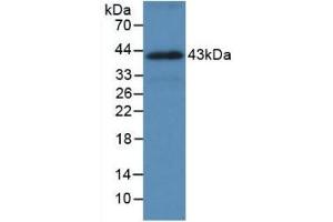 Detection of Recombinant HSPA1A, Human using Monoclonal Antibody to Heat Shock 70 kDa Protein 1A (HSPA1A) (HSP70 1A antibody  (AA 285-641))