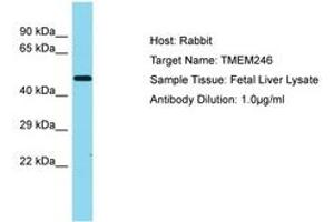 Image no. 1 for anti-Transmembrane Protein 246 (TMEM246) (AA 152-201) antibody (ABIN6750482) (TMEM246 antibody  (AA 152-201))