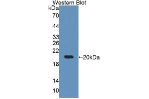 Detection of Recombinant DTYMK, Human using Polyclonal Antibody to Deoxythymidylate Kinase (DTYMK) (DTYMK antibody  (AA 43-190))