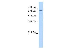 Lane: HepG2 cell lysate. (Glucuronidase beta antibody  (C-Term))
