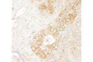 Immunohistochemistry (IHC) image for anti-Catenin, beta (CATNB) (AA 760-781) antibody (ABIN7448432) (beta Catenin antibody  (AA 760-781))