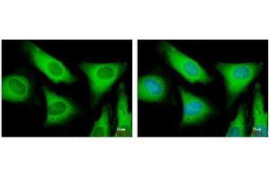 ICC/IF Image EIF2 beta antibody detects EIF2S2 protein at cytoplasm by immunofluorescent analysis. (EIF2S2 antibody)