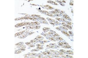 Immunohistochemistry of paraffin-embedded mouse stomach using IER3 antibody at dilution of 1:100 (x40 lens). (IER3 antibody)
