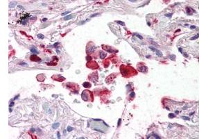 Image no. 1 for anti-Ionized Calcium-binding Adapter Molecule 1 (IBA1) (C-Term) antibody (ABIN492698) (Iba1 antibody  (C-Term))